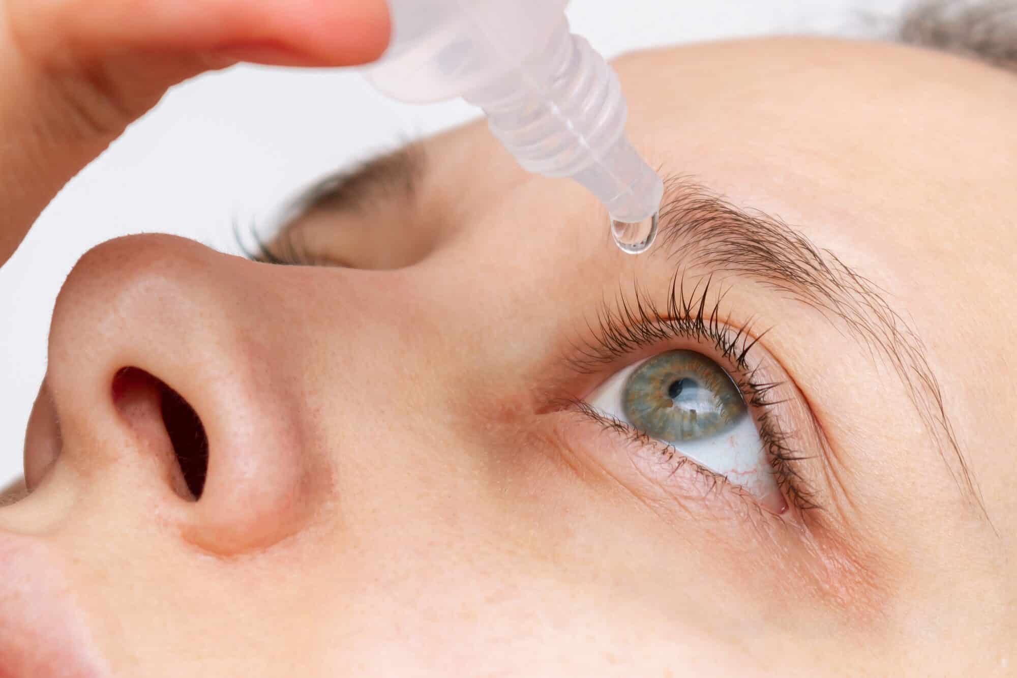 Artificial tears being applied to relieve dry eye symptoms